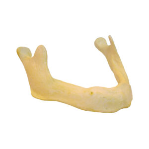 Lower mandible edentulous bone with cancellous and cortical bone tissue